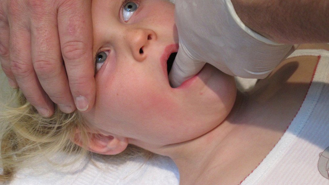 orthodontie osteopathie lien