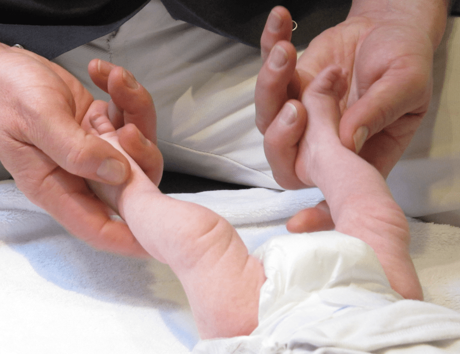 pieds nourrisson membres inferieurs