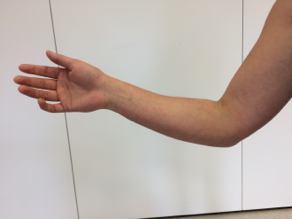 comment etirer mon coude